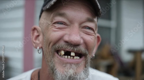 Smiling man shows missing teeth in a casual setting in a rural area during the day
