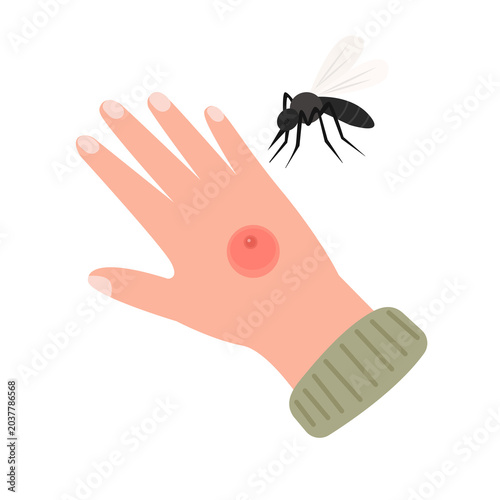 Obraz na plátně The human hand with the mosquito bite