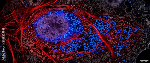 Microscopic view of viral particles inside an infected mammalian cell