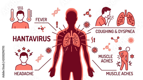 Hantavirus symptoms infographic showing fever headache coughing dyspnea and muscle aches in human body illustration. EPS Editable. Vector Illustrations.