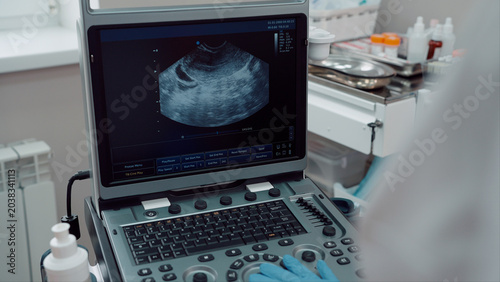 Slika na platnu Ultrasound machine in the clinic