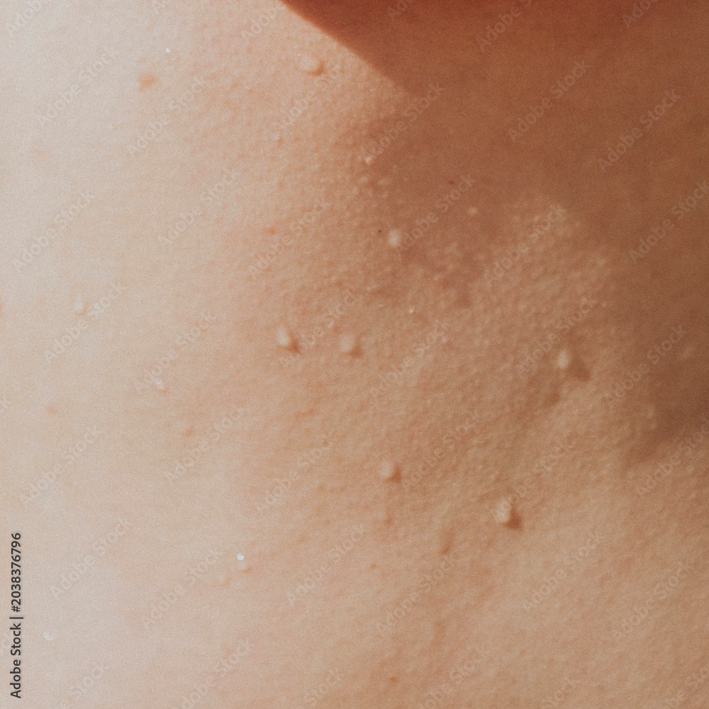 Fototapeta premium Sweaty woman's skin closeup