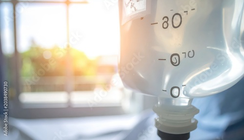 Close-up view of an intravenous IV drip bag showing fluid level markings and gentle sunlight filtering through a window.