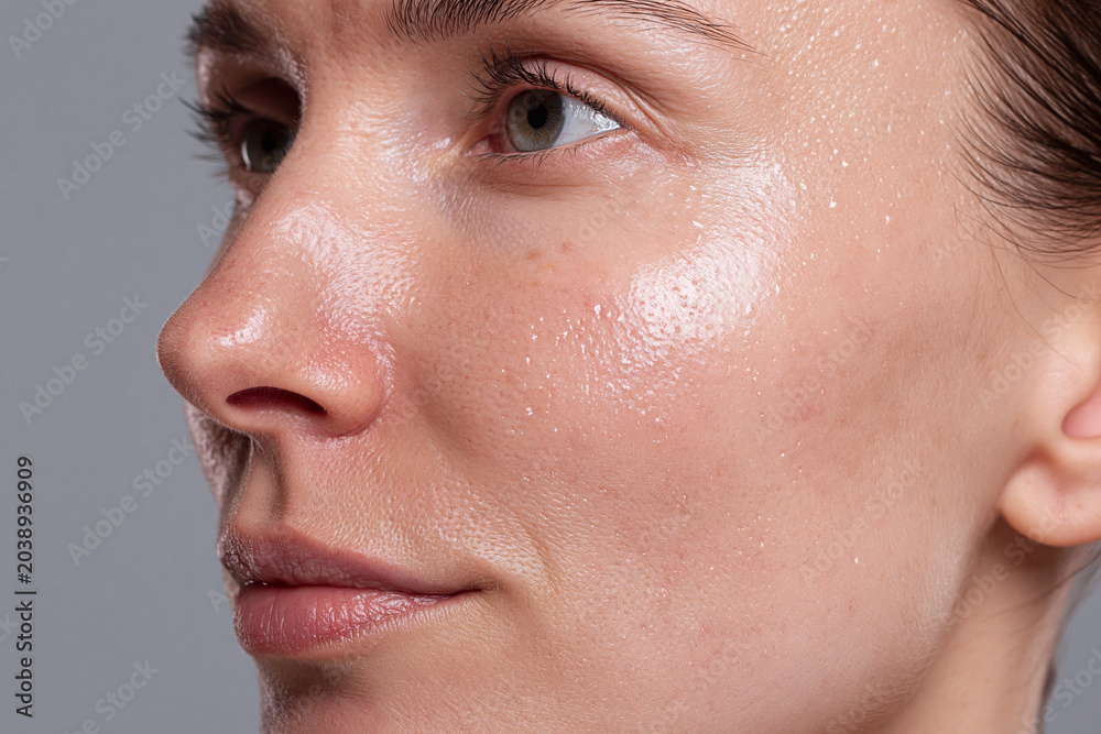 Fototapeta premium Oily skin close up with visible shine, clogged pores and natural texture on young adult female face conveying realistic skincare concern and subtle emotion