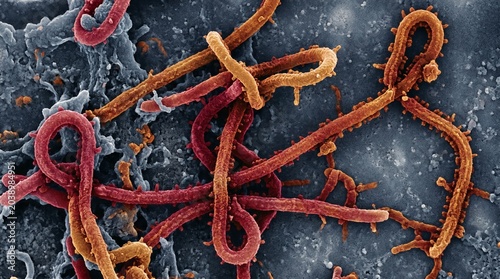 Scanning electron micrograph of ebola virus particles