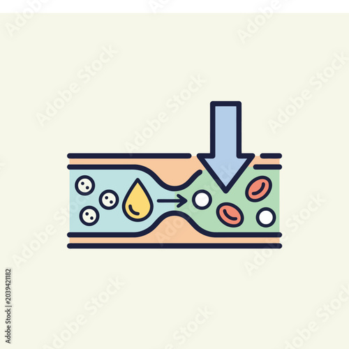 Bild auf Leinwand A medical illustration showing a constricted blood vessel pathway