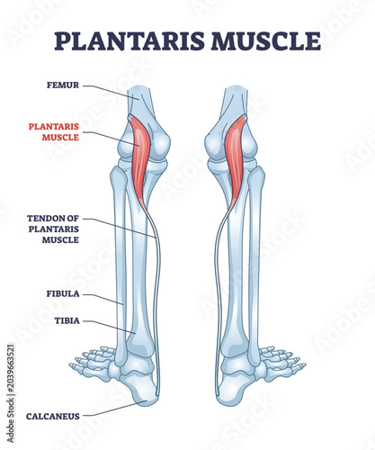 Quadro su tela Plantaris muscle as leg superficial posterior compartment part outline diagram, transparent background