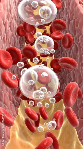 Red Blood Cells Flowing Through Blood Vessel with Bubbles - A close-up, illustrative view inside a blood vessel.