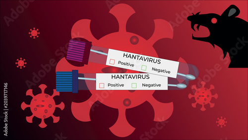 Hantavirus medical infographic banner. Vector illustration with positive and negative blood test tubes, virus cells structure background, and a silhouette of a rat as a disease vector.