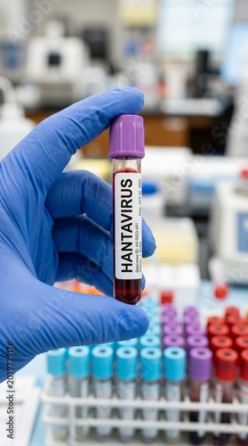 Close up of a gloved hand holding a medical blood test tube with a Hantavirus label in a laboratory setting, medical research and diagnostics concept.