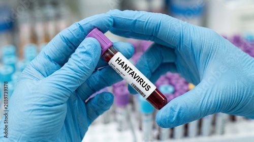 Close up of a gloved hand holding a medical blood test tube with a Hantavirus label in a laboratory setting, medical research and diagnostics concept.