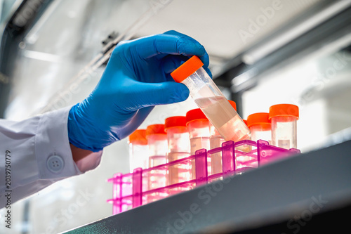 Bilde på lerret Unknown medical scientist concentrating on analyzing dangerous disease samples w