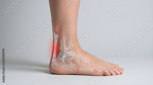 Achilles Tendon Inflammation and Ankle Pain Medical Anatomy Illustration