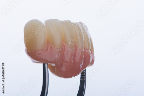 Dental bridge with artificial gum made of zirconium on two titanium abutments to fixation on implant