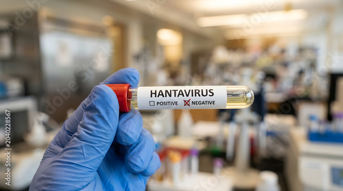 Close-up of a gloved hand holding a blood sample vial, blood test tube with a negative result for the Hantavirus Sin Nombre antibody test in a laboratory background.
