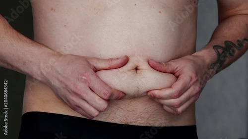 A man shows off his belly fat close-up, his obesity issues, and his dietary inconsistency.
The weight loss process