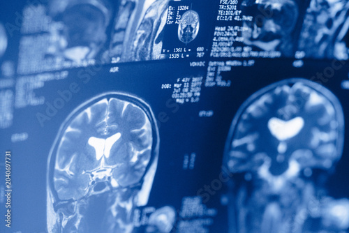 Quadro su tela Medical scans show detailed images of brain structures taken at a hospital radio