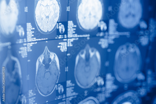 Medical imaging shows brain scans with clear details of structures in a clinical setting during daylight hours