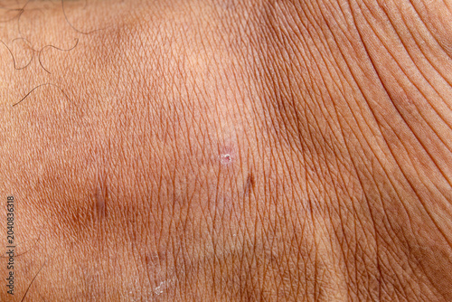 Cuadro en lienzo the texture of the skin on the feet of men with brown skin, with lines and wrink