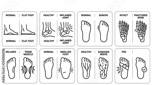 Obraz na płótnie Human Foot and Bone Conditions Medical Illustration Set.