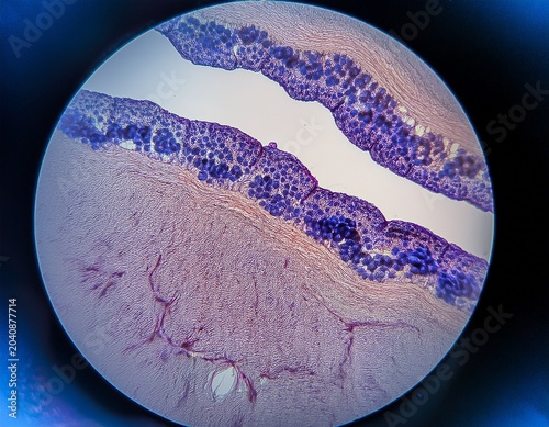 microscopic view of desquamated squamous cells from oral mucosa with dense blue bacterial colonies on right cell using he stain clean commercial composition professional context realistic detail