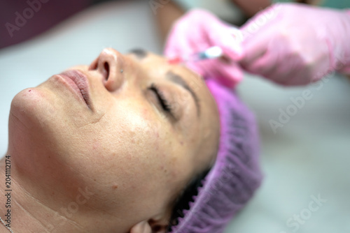 Bild auf Leinwand Woman receiving hyaluronic acid facial rejuvenation injection