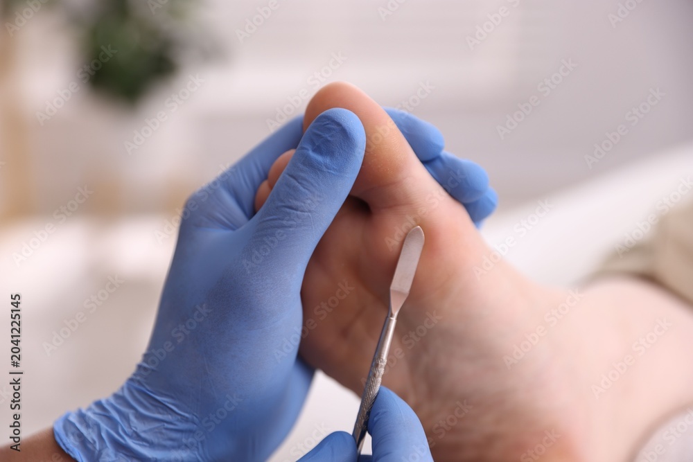 Fototapeta premium Podiatrist removing dead skin from client's foot with chisel tool indoors, closeup