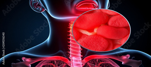 Human throat anatomy with inflamed tonsils and close-up view of red blood cells