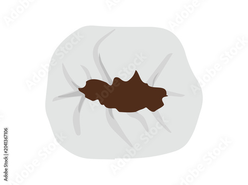 Human Tooth Decay Cavity Illustration
