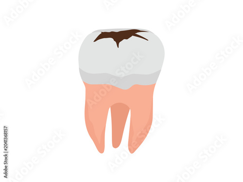 Hand Drawn Human Dental Decay
