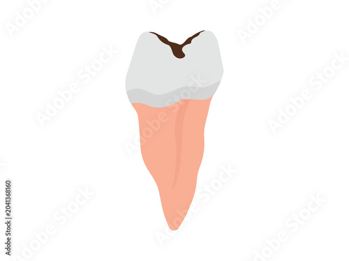 Hand Drawn Human Dental Decay