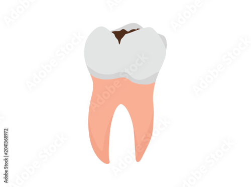 Human Tooth Cavity Clip Art
