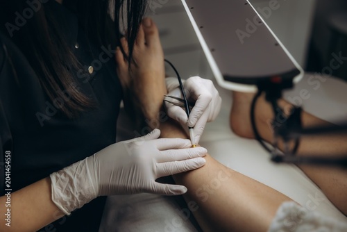 Tableau sur toile Professional performing electrolysis hair removal on leg