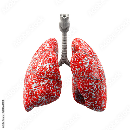 Professional Lung Disease Health Concept Isolated on White Background Usage