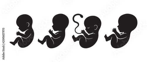 Εκτύπωση καμβά Set of black silhouette icons showing the stages of human fetus development during pregnancy