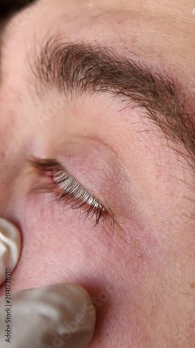 A young man applying eye drops. Effective medications for young people, eye drops, and vision problems.
