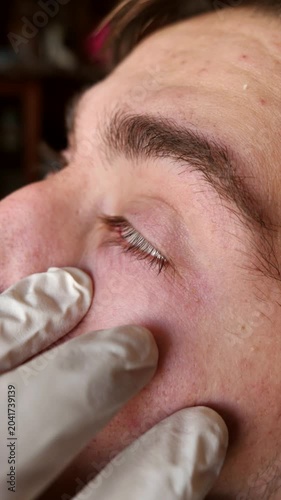A young man applying eye drops. Effective medications for young people, eye drops, and vision problems.