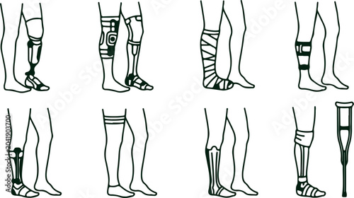 Bild auf Leinwand Collection of prosthetic legs and artificial limbs showcasing medical technology and assistive devices for rehabilitation and mobility
