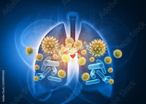 Obraz na plátně Anatomical human lungs with viral pathogens and bacterial infection on blue medical background