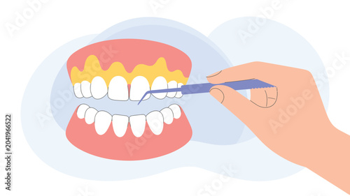 Canvas Print dental plaque removal procedure with scaler tool, oral hygiene and professional