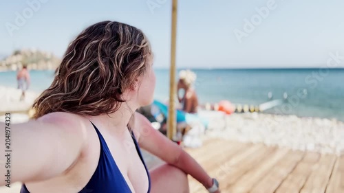 Vlogging the Reality: Sunburn on a Greek Holiday