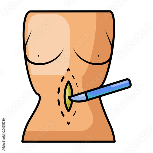 Obraz na płótnie laparotomy operation concept, abdominal surgery procedure vector icon design, su