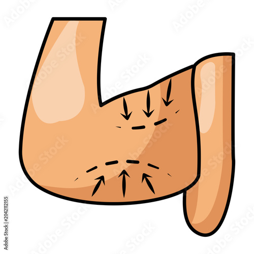 sagging upper arm skin tightening concept, bat wing arm reduction vector icon design, plastic surgery procedure stock illustration