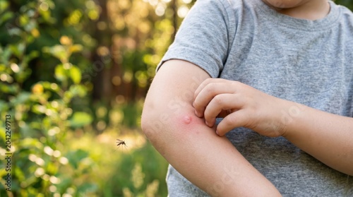 Child scratching a mosquito bite on the arm outdoors, representing itching, skin irritation, insect bites, summer health concerns, allergy symptoms and mosquito prevention
