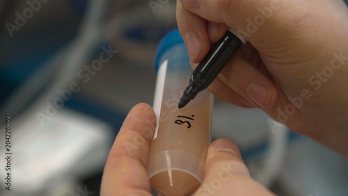Photos Detailed Writing Of Dates And Identifiers On Laboratory Sample Containers For Traceability
