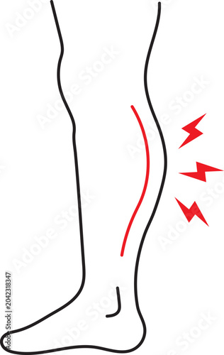 Leg pain medical vector illustration with red shin inflammation and warning bolts.