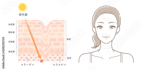 紫外線による光老化とエイジングサインの比較イラスト（しわ・たるみ・年齢肌）