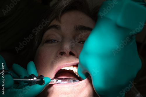 Photos Patient receiving a local anesthetic injection prior to root canal treatment in a dental clinic
