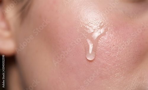 Closeup of a clear skincare serum drop on a persons cheek