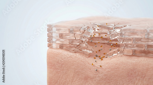 Damaged skin barrier illustration repair concept microscopic closeup dry texture cracked layer protection breakdown healing concept